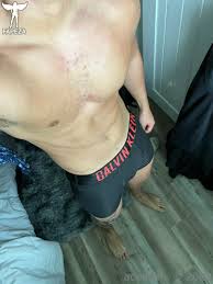 aceakers Nude Leaks OnlyFans Photo 6 - Fapeza