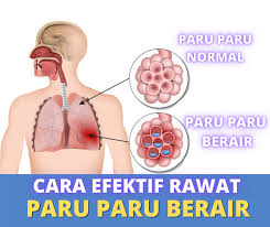 Apa saja obat yang bisa anda gunakan? Facebook