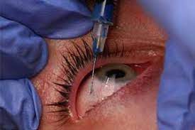 Medicare as of early 2010 provides a $50 reimbursement per injection when avastin is used for macular degeneration treatments. Faulty Administration Of Injection Avastin Ophthalmologist Told To Pay Rs 1 Lakh