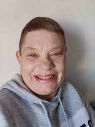 I did post this picture as a comment in someone else's post previously, I  was too shy. Then I thought no, this needs to be out there. 65, greying,  small bald patch,