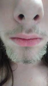 Aber wie bekommt man die haare schneller zum wachsen? Warum Habe Ich Einen Weissen Bart M20 Gesundheit Menschen Haare