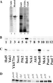 Our photo shoot was a great day. Pho85 Phosphorylates The Glc7 Protein Phosphatase Regulator Glc8 In Vivo Journal Of Biological Chemistry