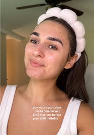 Understanding Cystic Acne: My Ongoing Journey