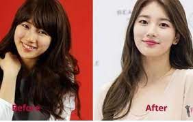 Pacar dari lee min ho ini juga punya kecantikan alami yang . Kwon Eunbi Dan 3 Idol Cantik Ini Pernah Dituduh Operasi Plastik Kumparan Com