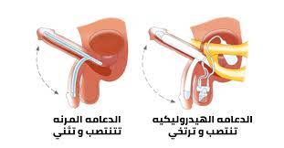 دعامة القضيب للانتصاب | ما هي، الأنواع، والتكلفة