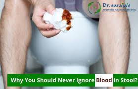 Image result for Blood in stool