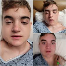 Rob fonts face swells so quickly it seems like. Or am i trippin?