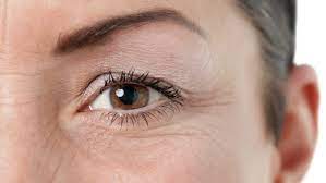 Goz Cevresi Kirisikliklarina Son Iste Mucize Tarifler Kiyafet Kombinleri Anti Aging Krem Gozler Cilt Urunleri