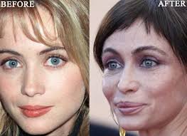 Emmanuelle beart (born august 14, 1965) is a french actress. Emmanuelle Beart Plastic Surgery Photo Before And After Celeb Surgery Com
