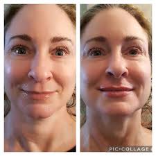 Aba_aestheticsbyadria