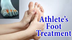 Sebahagian orang mengenali jangkitan kulat pada kuku kaki terutama biasa dialami pada ibu jari kaki sebagai cagu. Gatal Perit Pedih Kaki Ni Angkara Ulat Air Ini Antara Cara Penyelesainya Hilangkan Sakit Dengan Segera Semuanya Jdt