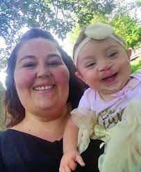 After her daughter was born with a bilateral cleft lip and palate, Crystal  Bridenstine, Marseilles, has set out to help bring more attention to the  condition through participation in CleftStrong 5K American