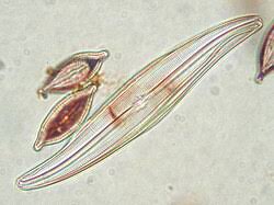 Image result for Gyrodoma hispida