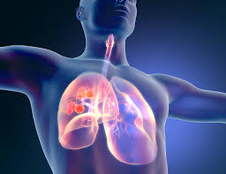 Maybe you would like to learn more about one of these? Nivolumab Ipilimumab Improves Os In Unresectable Malignant Pleural Mesothelioma