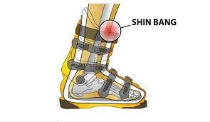 Orthopedic Surgeon Outlines the Science Behind Shin Bang 