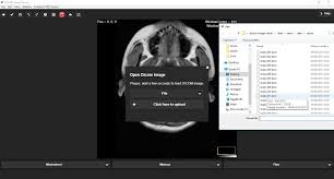 Maybe you would like to learn more about one of these? Top 12 Free Open Source Dicom Viewers And Pacs Workstations For Macos