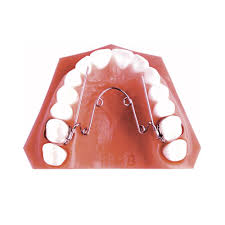 Khí cụ Quad – Helix: Hỗ trợ nong rộng hàm cho trẻ - Nha khoa Tâm Thiện Mỹ  Uy Tín Hưng Yên