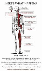Pin On Causes