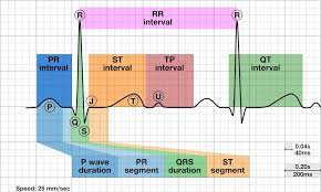 Maybe you would like to learn more about one of these? Kertas Sandapan Dan Gelombang Ekg Portal Medis Portal Kesehatan Akurat Dan Terpercaya