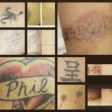 I actually don't mind if the tattoo gets ruined, i could always have it redone, i just don't want to do anything that would hurt or damage my skin. Dr Tattoff Laser Tattoo Removal And Laser Hair Removal Laser Tattoo Removal Tattoo Removal Laser Hair Removal