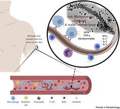 Advances In Vaccine Development For Human Lymphatic Filariasis Trends In Parasitology