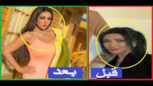 Search the world's information, including webpages, images, videos and more. ÙŠØ§Ø³Ù…ÙŠÙ† Ø§Ù„Ø®Ø·ÙŠØ¨ Ù‚Ø¨Ù„ Ø¹Ù…Ù„ÙŠØ§Øª Ø§Ù„ØªØ¬Ù…ÙŠÙ„ ÙˆØ¨Ø¹Ø¯Ù‡Ø§ Ø£ØºØ§Ù†ÙŠ Mp3 Ù…Ø¬Ø§Ù†Ø§
