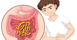 Image result for Chronic Constipation