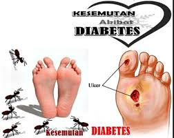 Tentunya dalam jangka panjang memiliki resiko kerusakan permanen. Berikut Tanda Tanda Kencing Manis Kering Yang Perlu Kita Ketahui Tanda Pengikut
