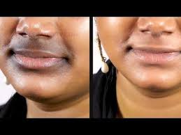 Pin On Skin Care Hyperpigmentation