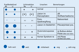 Jika dulu glasgow coma scale alias gcs hanya digunakan untuk mengetahui kesadaran seseorang setelah mengalami cedera kepala, kini metode ini juga digunakan para dokter untuk menilai tingkat kesadaran karena berbagai kondisi gawat darurat medis lainnya. Abklarung Der Akuten Bewusstseinsstorung Bei Sauglingen Kindern Und Jugendlichen Springerlink