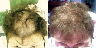 Actual users' toppik reviews show that application of the product really does have some good effects: The Toppik Review Ultimate Guide Before You Buy 2021 Hairguard