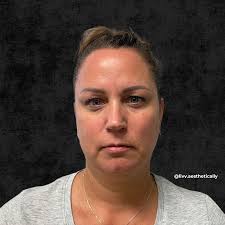 Albuquerque Dermatology