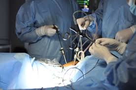 Tratamentul in apendicita este chirurgical, prin rezectia apendicelui, laparoscopic sau clasic, in afara cazurilor de plastron apendicular. Operatie Apendicita Laparoscopic Pret Asdgfjf