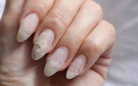 كن أول من يقيم ملصقات اظافر متعدد الالوان إلغاء الرد. Ø¹Ù„Ø§Ø¬ Ø£Ø¸Ø§ÙØ± Ø§Ù„Ù‚Ø¯Ù… Ø§Ù„Ù…ØªØ´Ù‚Ù‚Ø© Ø·Ø¨ÙŠØ¹ÙŠØ§ Ø¨Ø§Ù„Ù…Ù†Ø²Ù„ Ø§Ù„Ù…Ø±Ø³Ø§Ù„