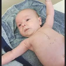 Mathew has been a fighter since before he was born. Megan (Mathew's mom was  28 weeks pregnant when she learned her baby had Tetralogy of Fallot (TOF),  a rare and complex heart