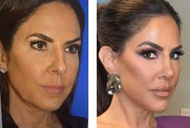 Dr Sam Rizk (@drsamrizk) • Instagram photos and videos