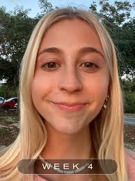 Reviewed: I Tried Aurelia Probiotic Skincare to Help My Acne