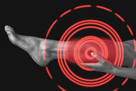 Blood clotting, or coagulation, is an important process that prevents excessive bleeding when a blood vessel is injured. Deep Vein Blood Clots Know The Signs Harvard Health