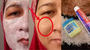 Check spelling or type a new query. Anda Boleh Dapatkan Kulit Yang Flawless Dengan Bajet Bawah Rm20 Whitehead Dan Blackhead Pun Boleh Hilang Tau