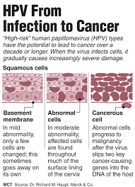 Cervical cancer begins on the lower part of the uterus, called the cervix, the area that opens into the vagina.it is difficult for you to see on your own. Pin On Cervical Carcinoma