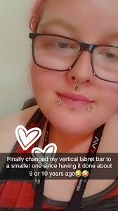 What could be causing a bump