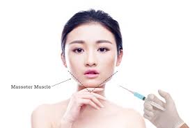 Sticking to your scheduled botox masseter treatment plan is important. 8 Things You Must Know About Botox For V Line Jaw Slimming 8 Medical Aesthetic