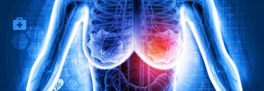 Kommission mamma der arbeitsgemeinschaft gynäkologische onkologie (ago) e.v. Brustkrebs Pd1 Hemmer Punktet Unabhangig Vom Chemotherapie Partner Medical Tribune