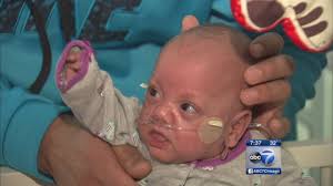 Baby born at 13 oz. gets to go home 5 months later