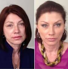 Andre Susanto (andresusanto)