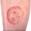 So, does hand sanitizer really kill coronavirus? Https Encrypted Tbn0 Gstatic Com Images Q Tbn And9gcr7yzq8z5yapshvwurnbxdptiylbvw9jvlx2k0j D0 O3il Xra Usqp Cau