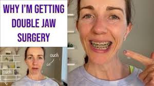 Jaw Surgery
