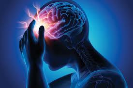 Stroke (Brain Attack): Types, Causes, Signs, Symptoms - Yashoda Hospital