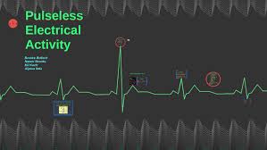 Image result for Pulseless Electrical Activity