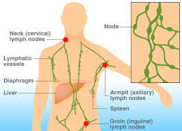 Most kids and teens who get hodgkin lymphoma get better. Pin On Non Hodgkins Lymphoma